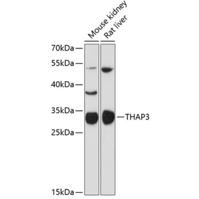Western Blot - Anti-THAP3 Antibody (A89002) - Antibodies.com