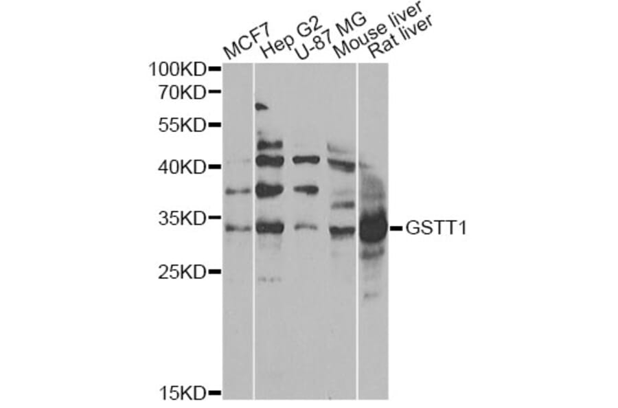 Western Blot - Anti-GSTT1 Antibody (A13996) - Antibodies.com