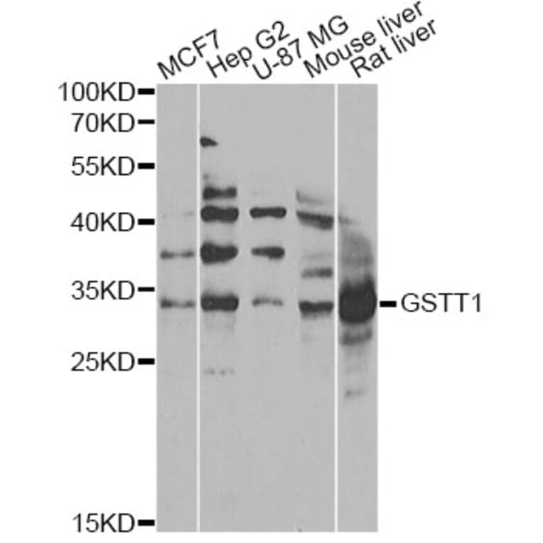 Western Blot - Anti-GSTT1 Antibody (A13996) - Antibodies.com