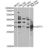 Western Blot - Anti-GSTT1 Antibody (A13996) - Antibodies.com