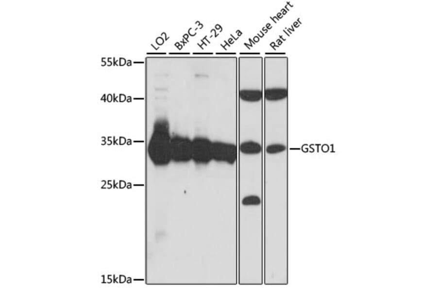 Western Blot - Anti-glutathione S transferase Omega 1/p28 Antibody (A89004) - Antibodies.com