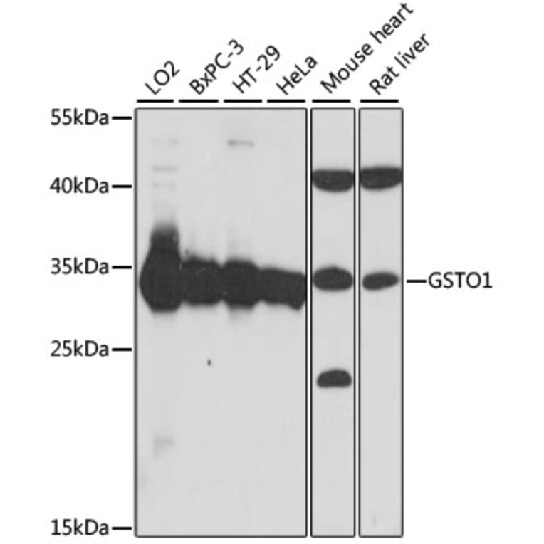 Western Blot - Anti-glutathione S transferase Omega 1/p28 Antibody (A89004) - Antibodies.com