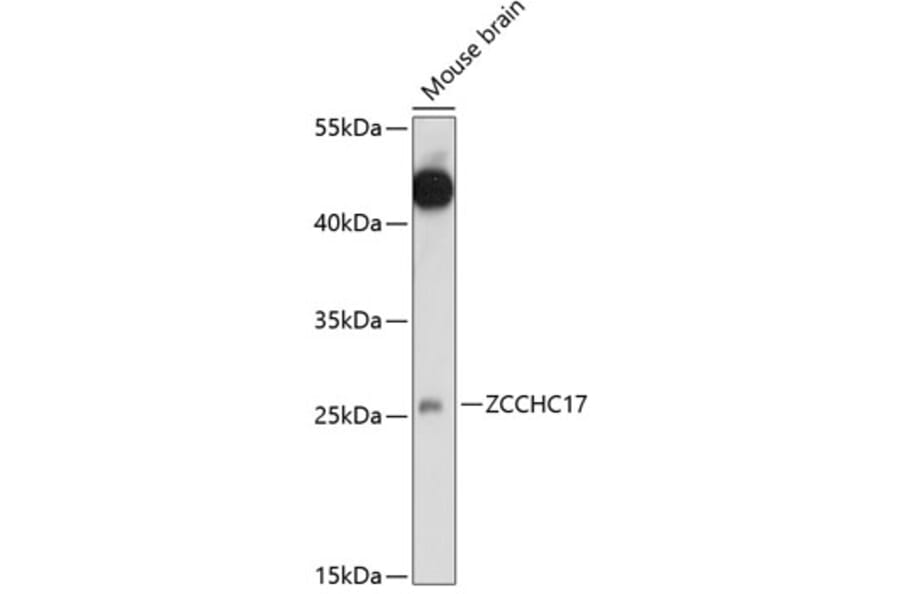 Western Blot - Anti-ZCCHC17 Antibody (A89005) - Antibodies.com
