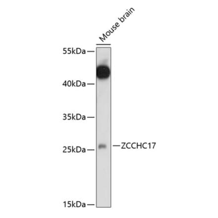 Western Blot - Anti-ZCCHC17 Antibody (A89005) - Antibodies.com