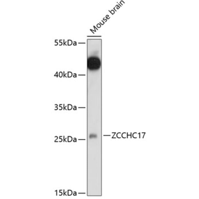 Western Blot - Anti-ZCCHC17 Antibody (A89005) - Antibodies.com