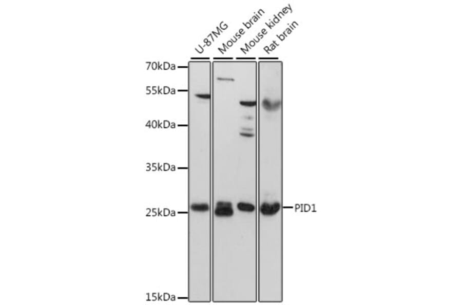 Western Blot - Anti-PID1 Antibody (A89006) - Antibodies.com