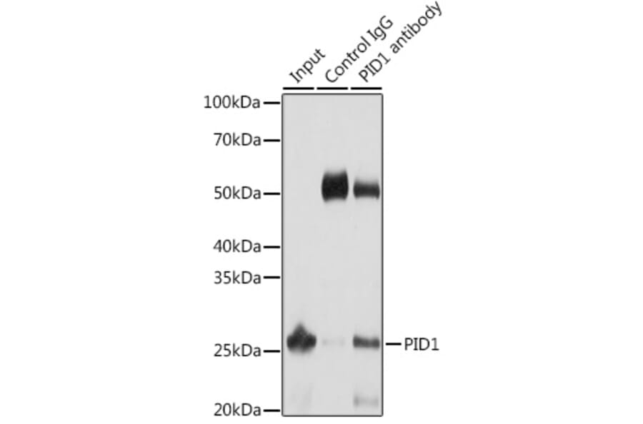 Western Blot - Anti-PID1 Antibody (A89006) - Antibodies.com