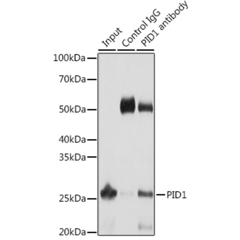 Western Blot - Anti-PID1 Antibody (A89006) - Antibodies.com