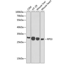 Western Blot - Anti-RPS3 Antibody (A89007) - Antibodies.com