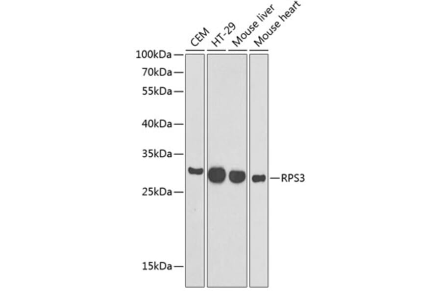 Western Blot - Anti-RPS3 Antibody (A89007) - Antibodies.com