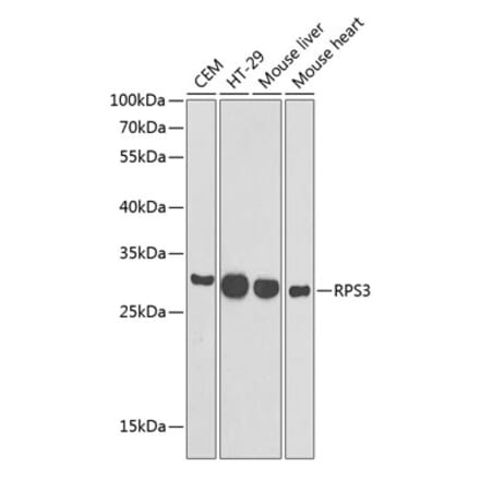 Western Blot - Anti-RPS3 Antibody (A89007) - Antibodies.com