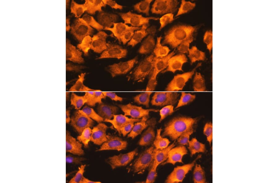 Immunofluorescence - Anti-RPS3 Antibody (A89007) - Antibodies.com