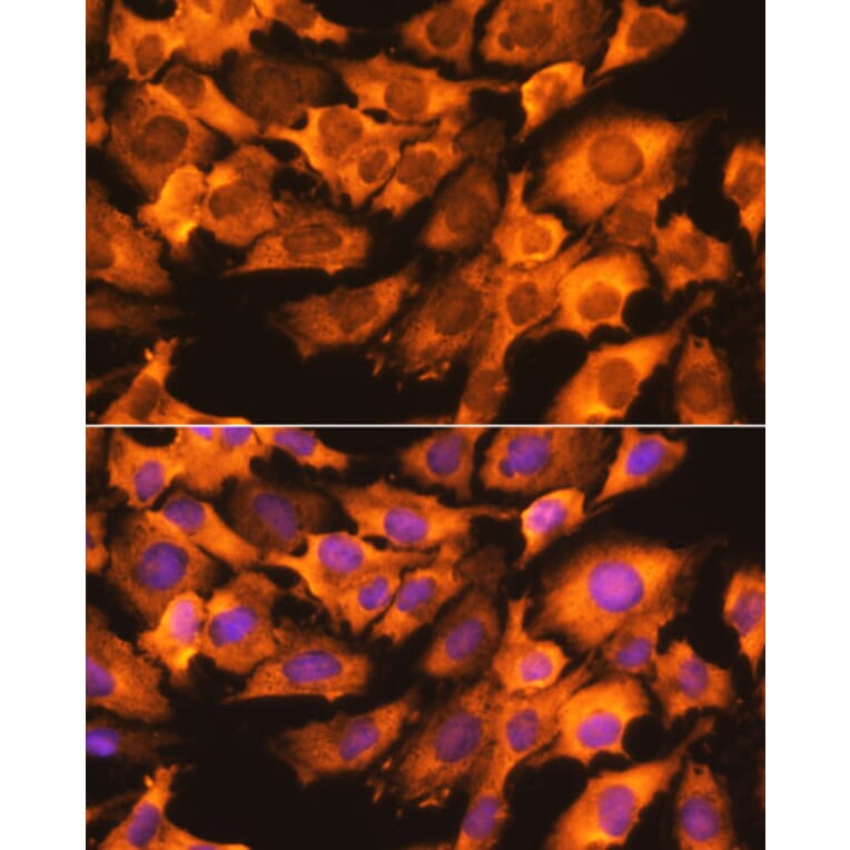 Immunofluorescence - Anti-RPS3 Antibody (A89007) - Antibodies.com