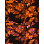 Immunofluorescence - Anti-RPS3 Antibody (A89007) - Antibodies.com