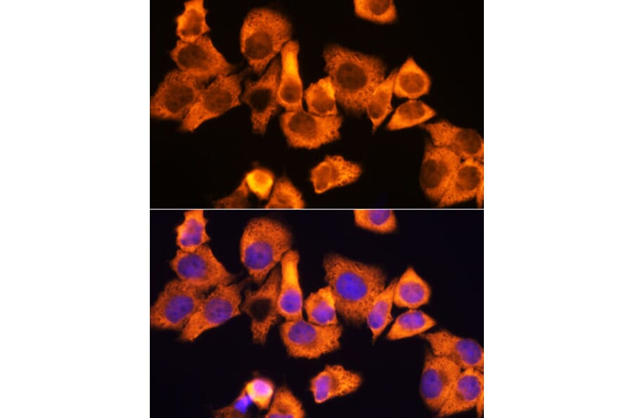 Immunofluorescence - Anti-RPS3 Antibody (A89007) - Antibodies.com