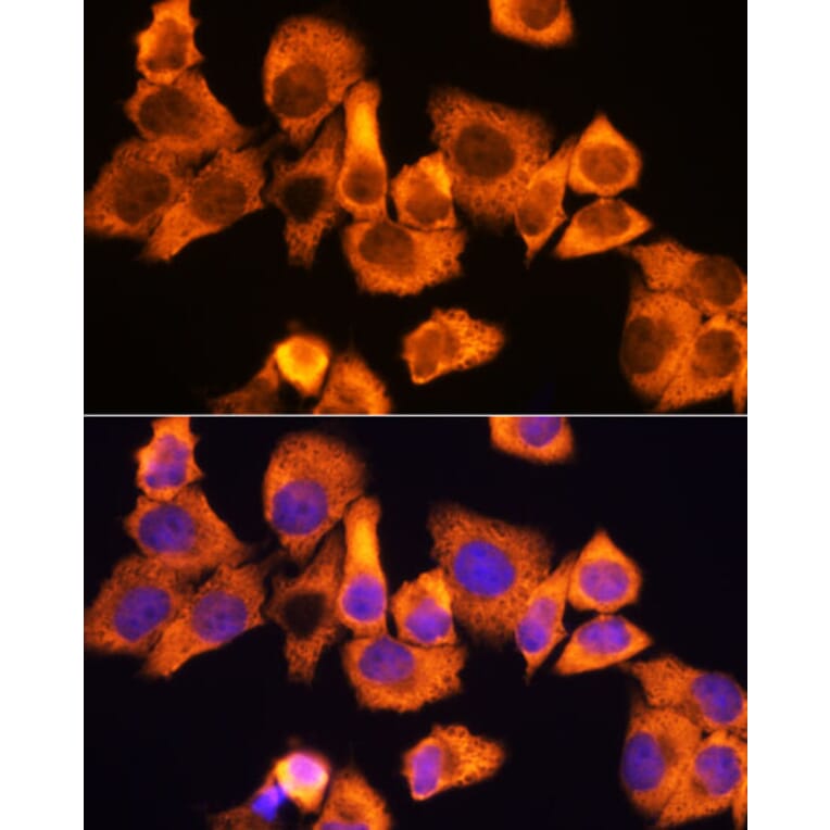 Immunofluorescence - Anti-RPS3 Antibody (A89007) - Antibodies.com
