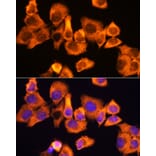 Immunofluorescence - Anti-RPS3 Antibody (A89007) - Antibodies.com