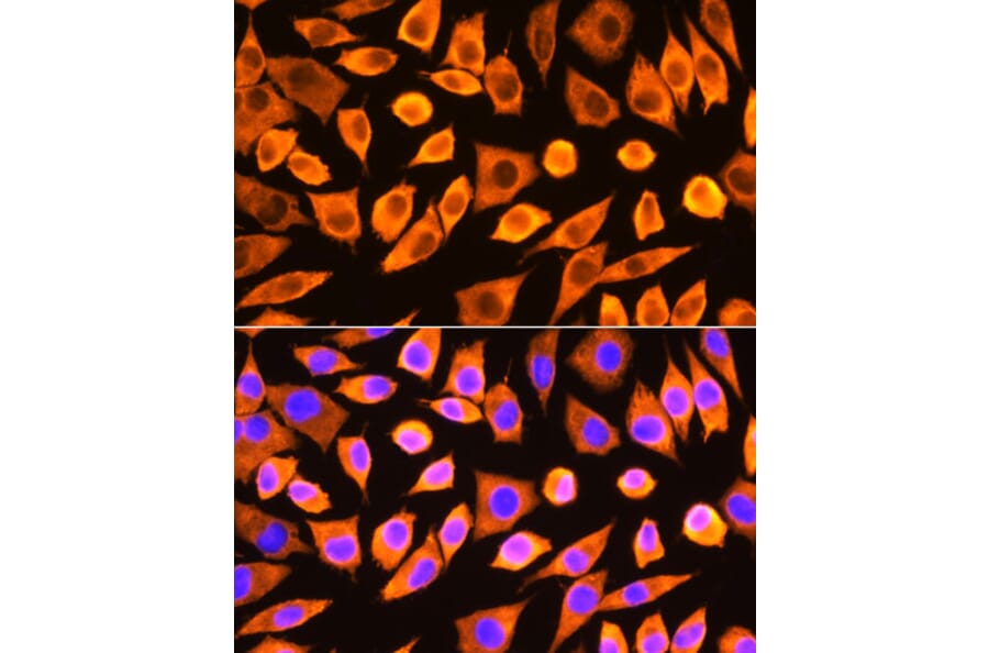Immunofluorescence - Anti-RPS3 Antibody (A89007) - Antibodies.com
