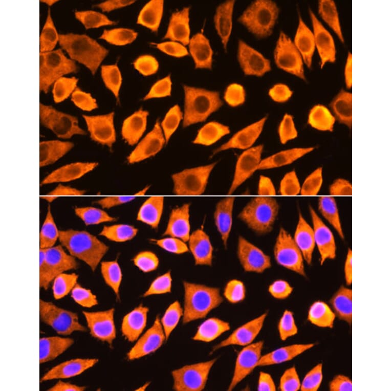 Immunofluorescence - Anti-RPS3 Antibody (A89007) - Antibodies.com