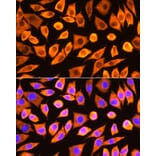 Immunofluorescence - Anti-RPS3 Antibody (A89007) - Antibodies.com