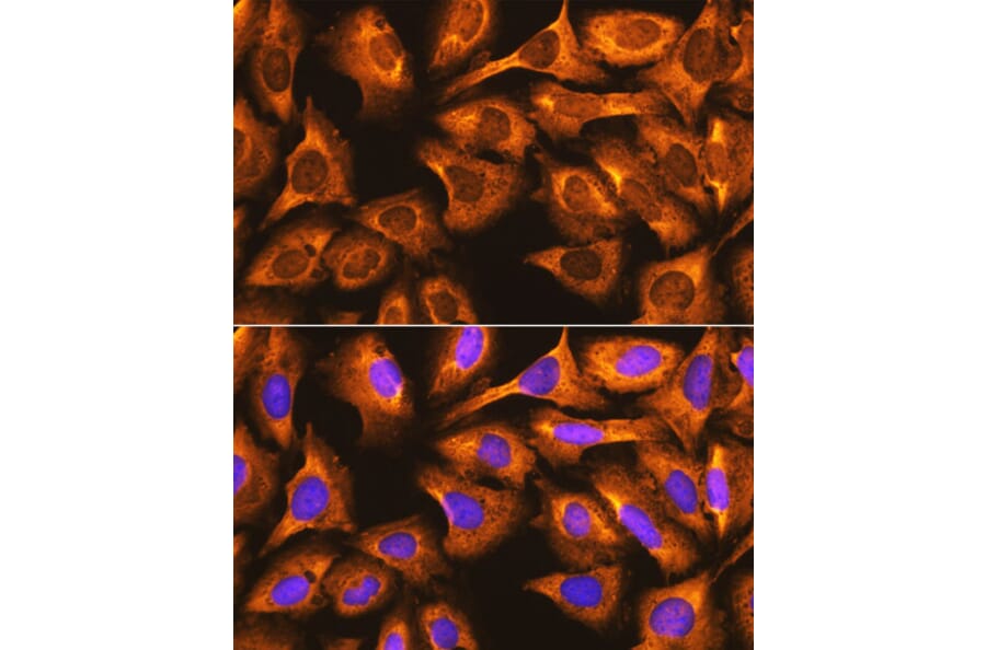 Immunofluorescence - Anti-RPS3 Antibody (A89007) - Antibodies.com