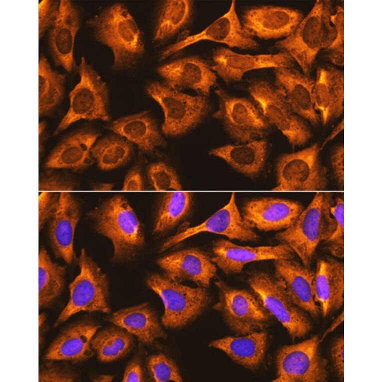 Immunofluorescence - Anti-RPS3 Antibody (A89007) - Antibodies.com