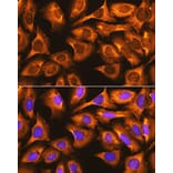 Immunofluorescence - Anti-RPS3 Antibody (A89007) - Antibodies.com