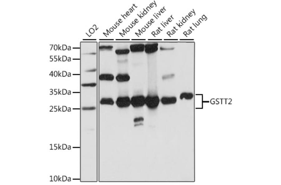 Western Blot - Anti-GSTT2 Antibody (A89008) - Antibodies.com