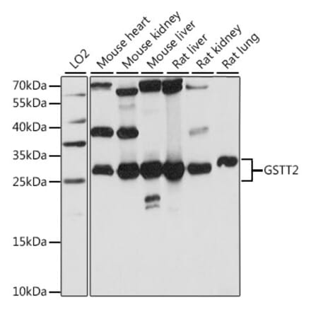 Western Blot - Anti-GSTT2 Antibody (A89008) - Antibodies.com