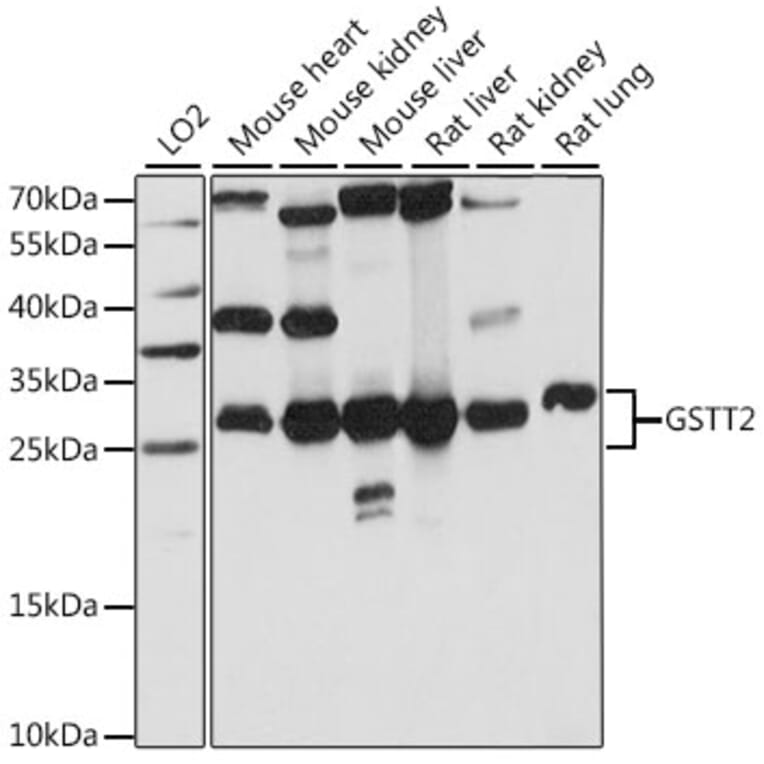 Western Blot - Anti-GSTT2 Antibody (A89008) - Antibodies.com