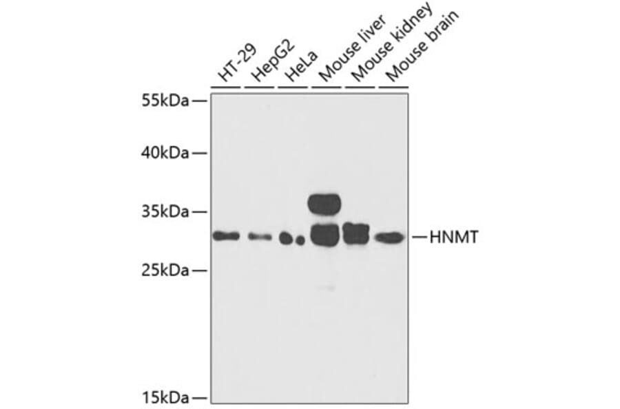 Western Blot - Anti-HMT Antibody (A89009) - Antibodies.com