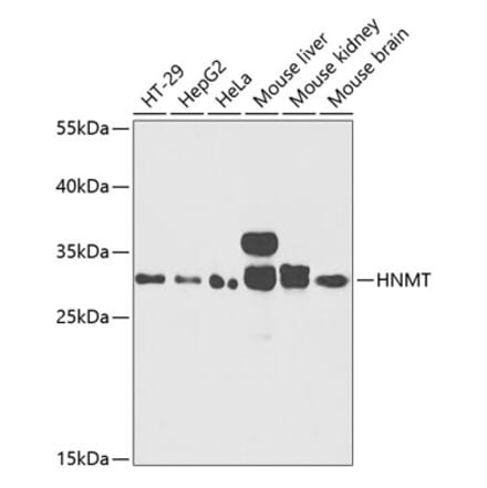 Western Blot - Anti-HMT Antibody (A89009) - Antibodies.com