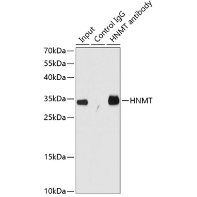 Western Blot - Anti-HMT Antibody (A89009) - Antibodies.com