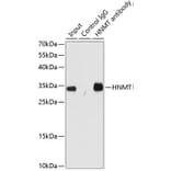 Western Blot - Anti-HMT Antibody (A89009) - Antibodies.com