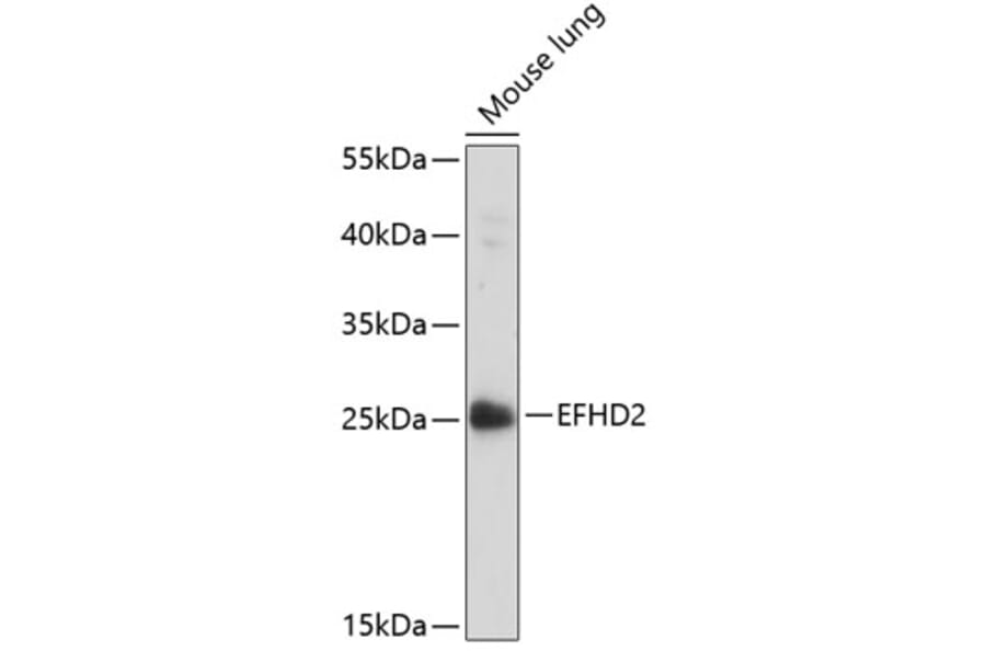 Western Blot - Anti-EFHD2/SWS1 Antibody (A89010) - Antibodies.com