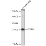 Western Blot - Anti-EFHD2/SWS1 Antibody (A89010) - Antibodies.com