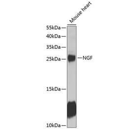 Western Blot - Anti-NGF Antibody (A89011) - Antibodies.com