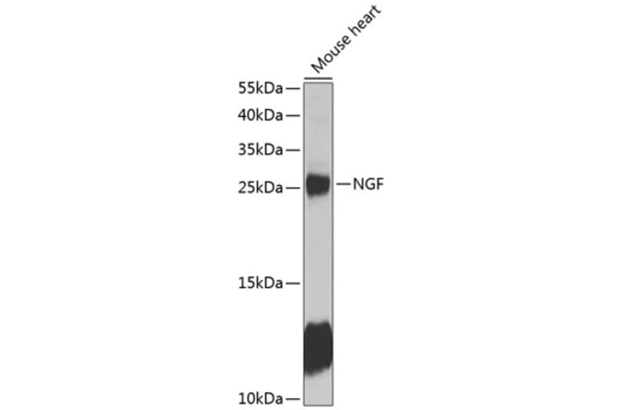 Western Blot - Anti-NGF Antibody (A89011) - Antibodies.com