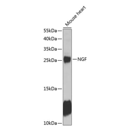 Western Blot - Anti-NGF Antibody (A89011) - Antibodies.com
