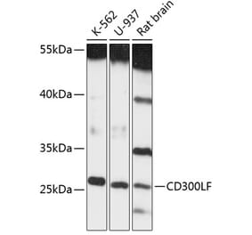 Western Blot - Anti-CD300 Antibody (A89012) - Antibodies.com