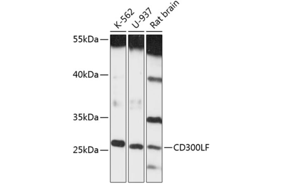 Western Blot - Anti-CD300 Antibody (A89012) - Antibodies.com