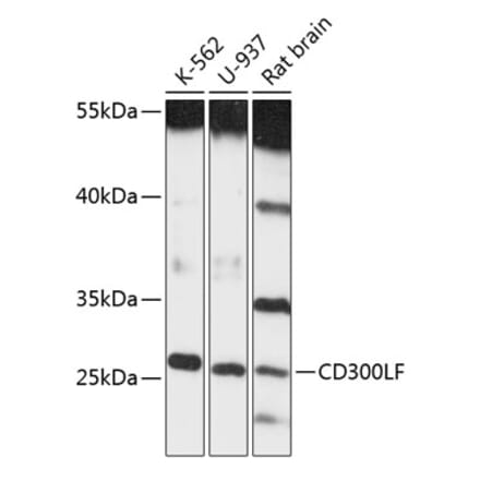 Western Blot - Anti-CD300 Antibody (A89012) - Antibodies.com