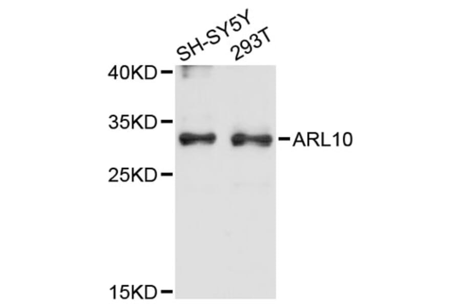 Western Blot - Anti-ARL10 Antibody (A12800) - Antibodies.com