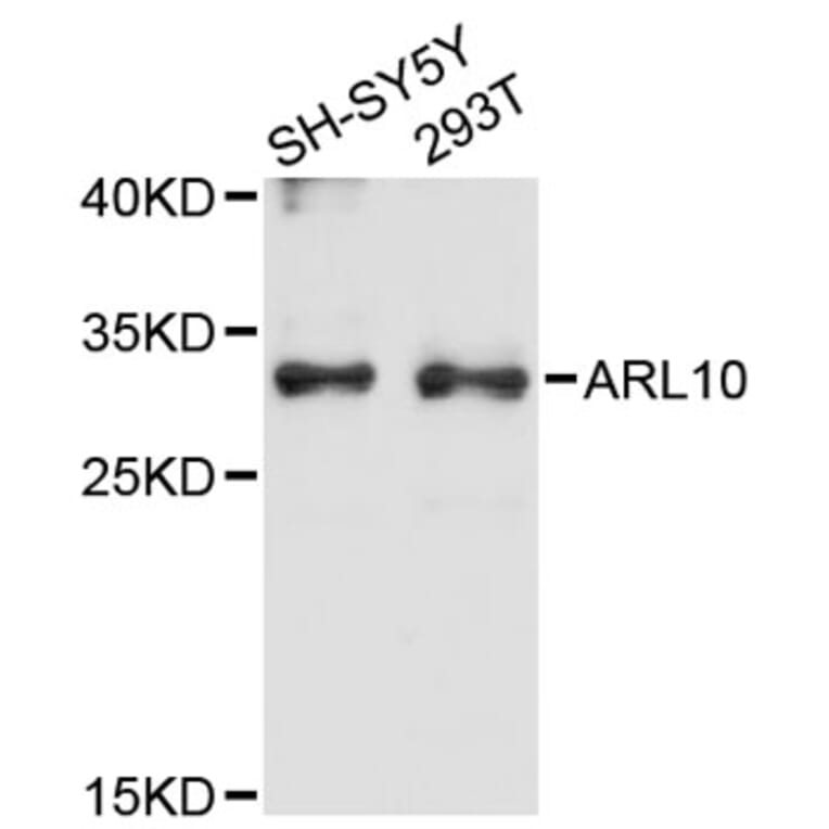 Western Blot - Anti-ARL10 Antibody (A12800) - Antibodies.com