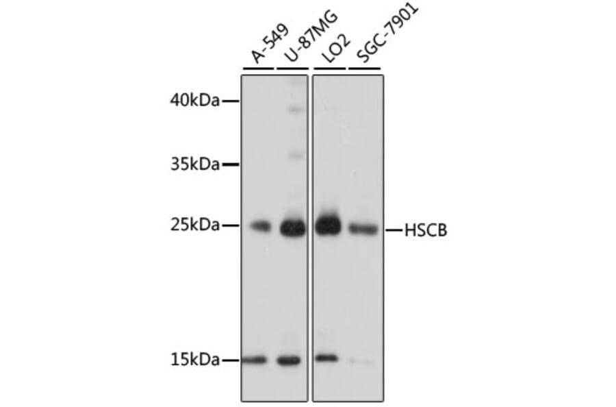 Western Blot - Anti-HSCB Antibody (A89015) - Antibodies.com