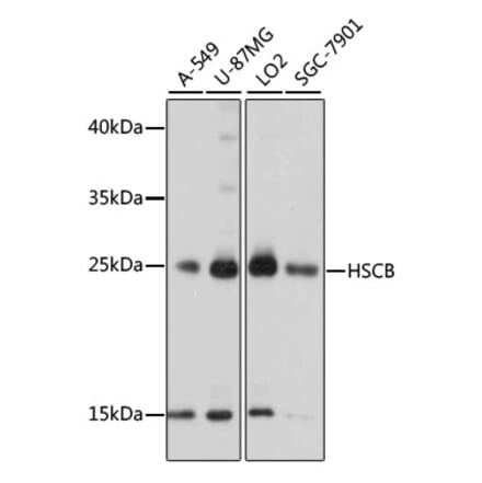 Western Blot - Anti-HSCB Antibody (A89015) - Antibodies.com