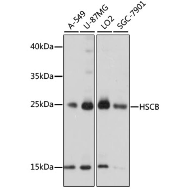 Western Blot - Anti-HSCB Antibody (A89015) - Antibodies.com