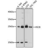 Western Blot - Anti-HSCB Antibody (A89015) - Antibodies.com