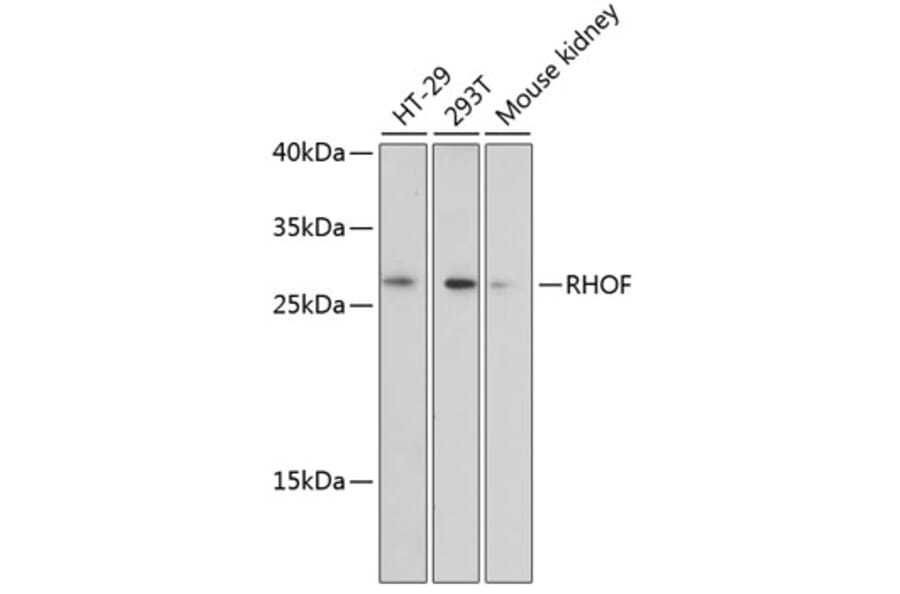 Western Blot - Anti-RhoF Antibody (A89016) - Antibodies.com