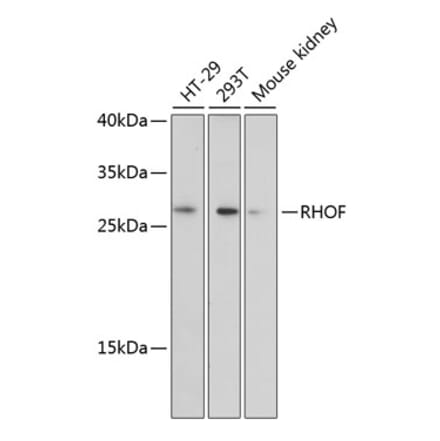 Western Blot - Anti-RhoF Antibody (A89016) - Antibodies.com